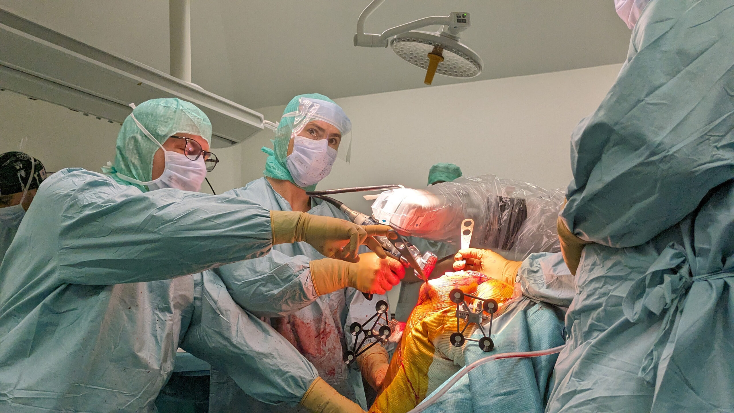 Déjà 100 interventions avec le robot MAKO à l'Hôpital Saint Joseph grâce à  la SNEF ! Merci !