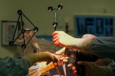 🚀 1500ème UTILISATION pour le robot MAKO !